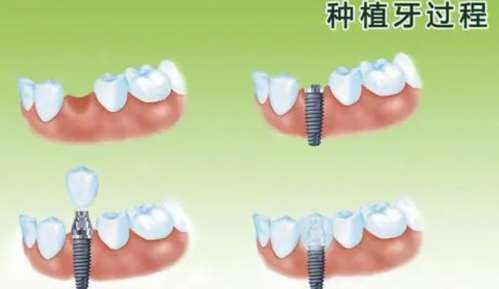 http://www.rmcbs.cn/d/file/price/vmyy82vygo94.jpg