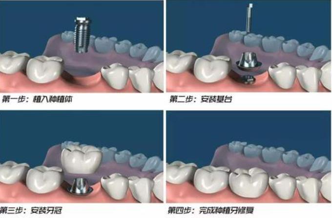 http://www.rmcbs.cn/d/file/price/xexsdr8biy.jpg