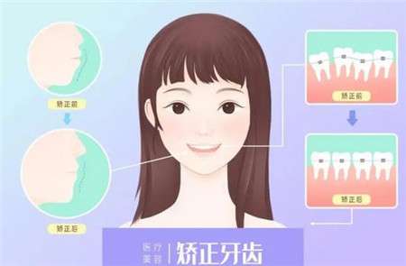 http://www.rmcbs.cn/d/file/price/zrzl6bts4s.jpg