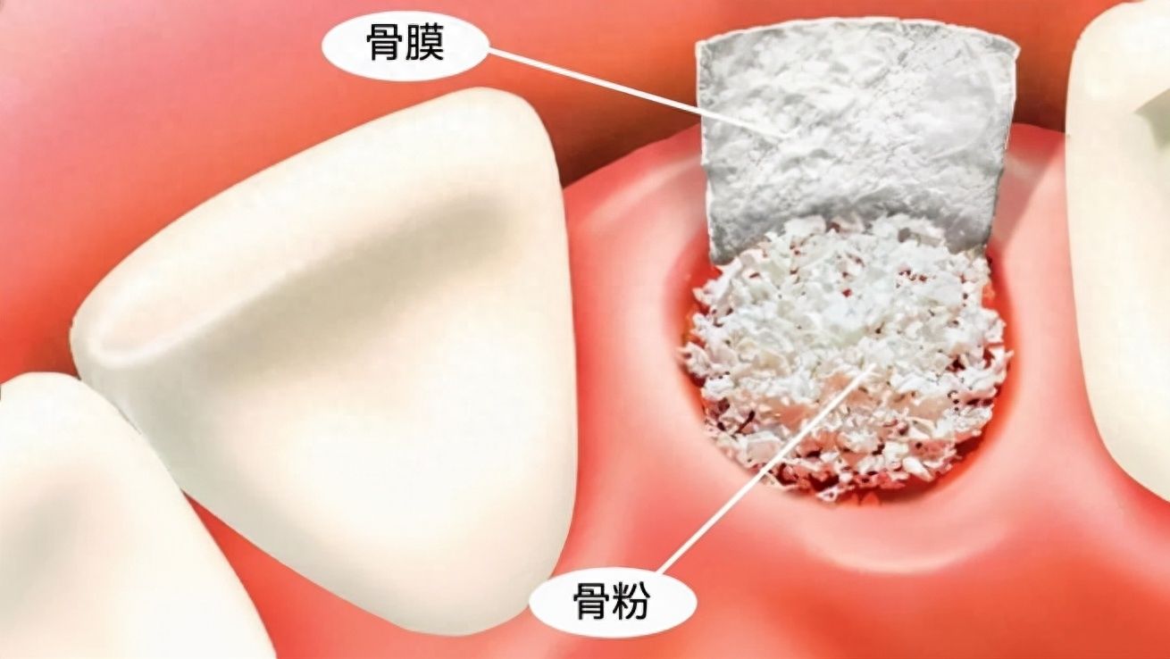 http://www.rmcbs.cn/d/file/price/zw0blpjth1je.jpg
