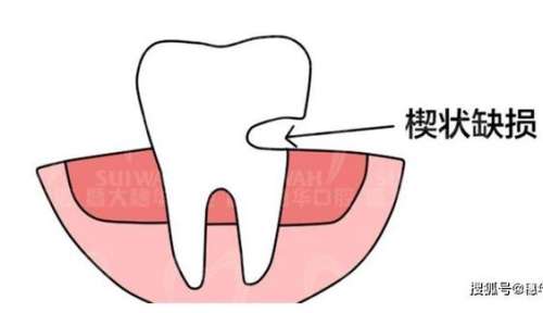 http://www.rmcbs.cn/d/file/rank/1xedfrm28kyr.jpg