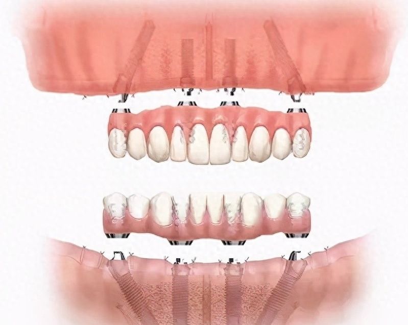 http://www.rmcbs.cn/d/file/rank/bgjarq9i3bxr.jpg