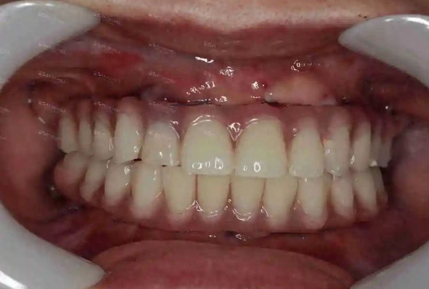 http://www.rmcbs.cn/d/file/rank/h4h02lreckhs.jpg