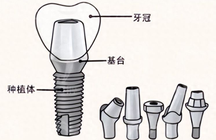 http://www.rmcbs.cn/d/file/rank/llujpvblfm8q.jpg