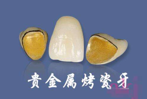 http://www.rmcbs.cn/d/file/rank/mixsm96w1lmu.jpg