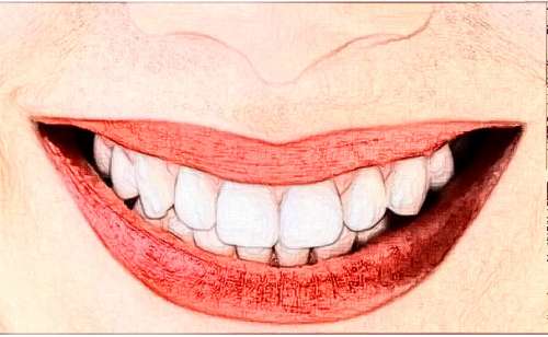 東莞恒好口腔門(mén)診：醫(yī)生簡(jiǎn)介+種植牙案例及價(jià)格【2024最新分享】