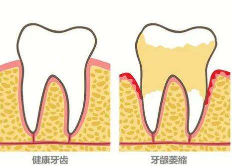http://www.rmcbs.cn/d/file/rank/pvxhkcmlv4v7.jpg