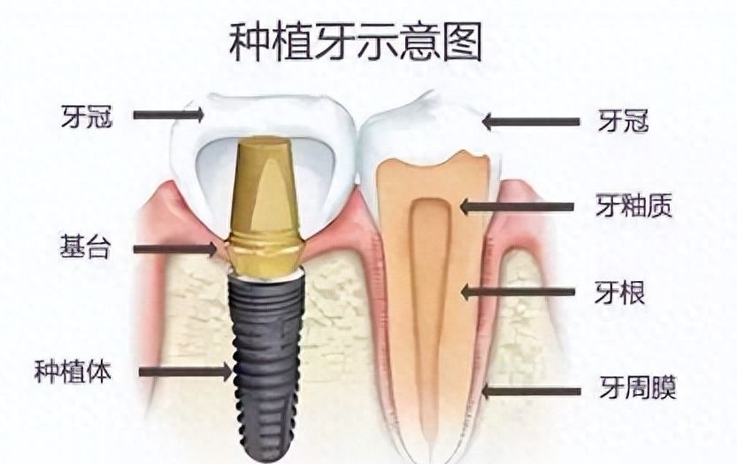 景德鎮(zhèn)口碑好的牙科醫(yī)院：正畸醫(yī)生推薦、成功案例展示
