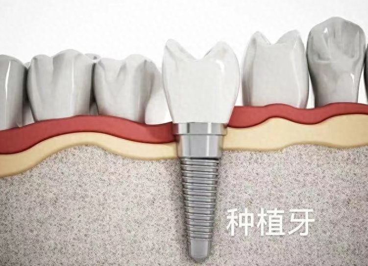 http://www.rmcbs.cn/d/file/rank/scs5gqt02bdm.jpg
