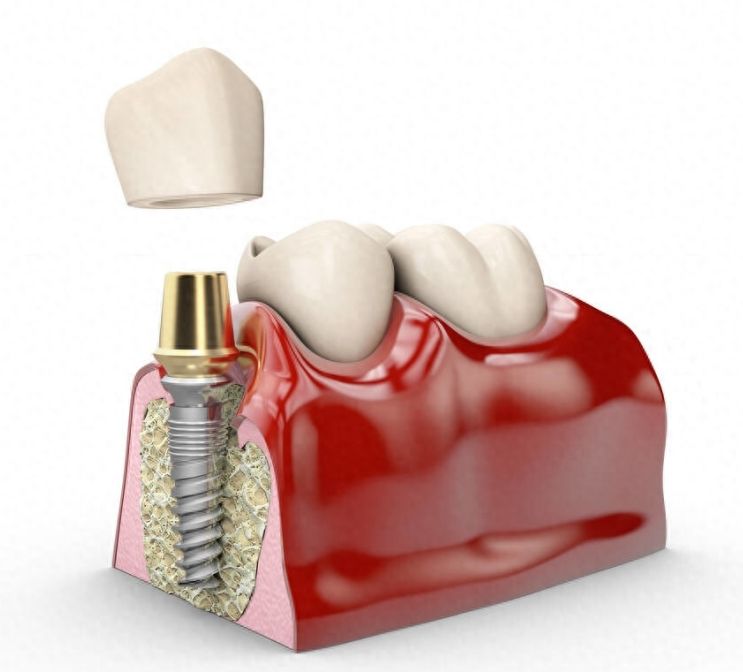 http://www.rmcbs.cn/d/file/rank/tw58f70d2yit.jpg