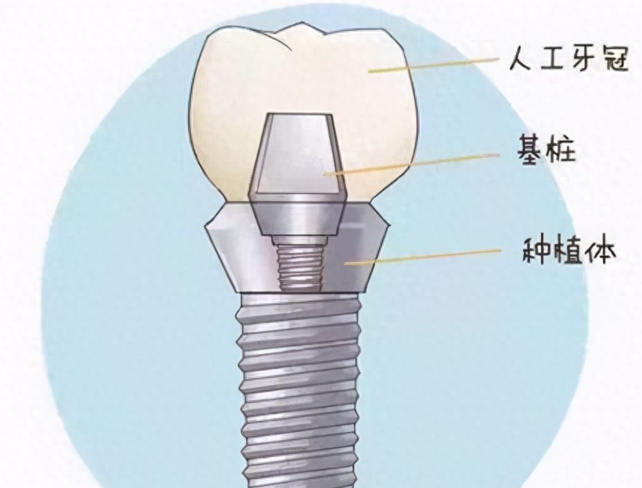 大連潔雅口腔醫(yī)院張健醫(yī)生治療效果如何？