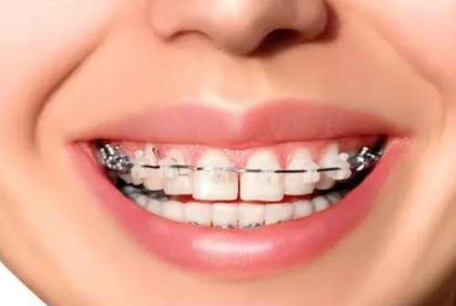 http://www.rmcbs.cn/d/file/rank/xn300qd5iyd8.jpg